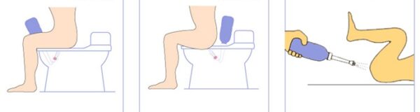 Portable Bidet Device Private Vaginal  Flusher Maternal Perineal Baby Baby Butt Ass Cleaner - Image 2
